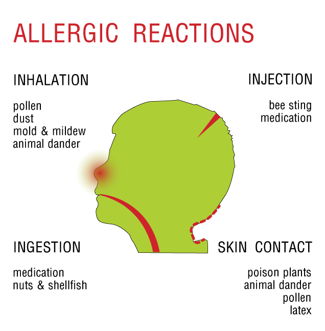 alergické reakce