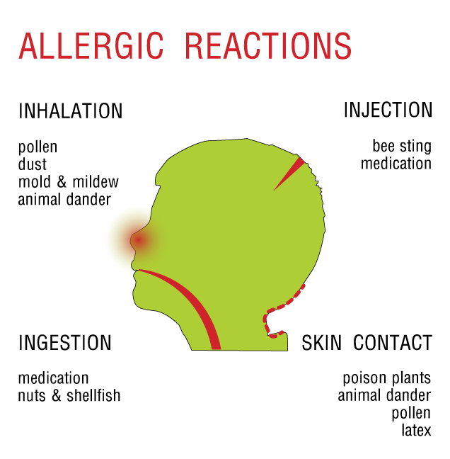 allergic reactions